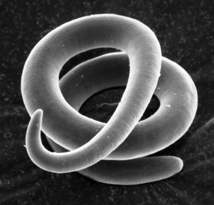 These parasites are commonly found in carnivores, including bears and cougars.